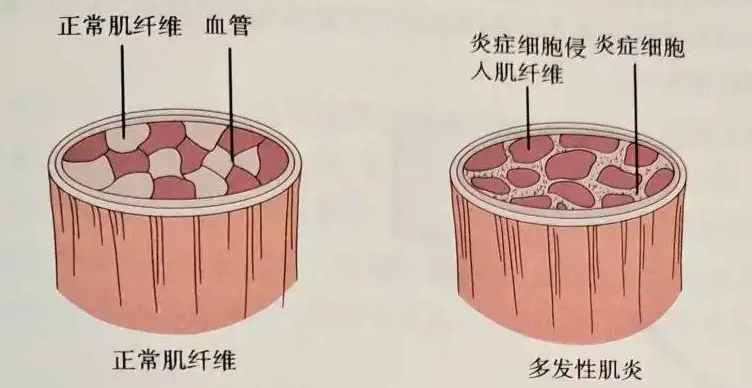圖文圖片