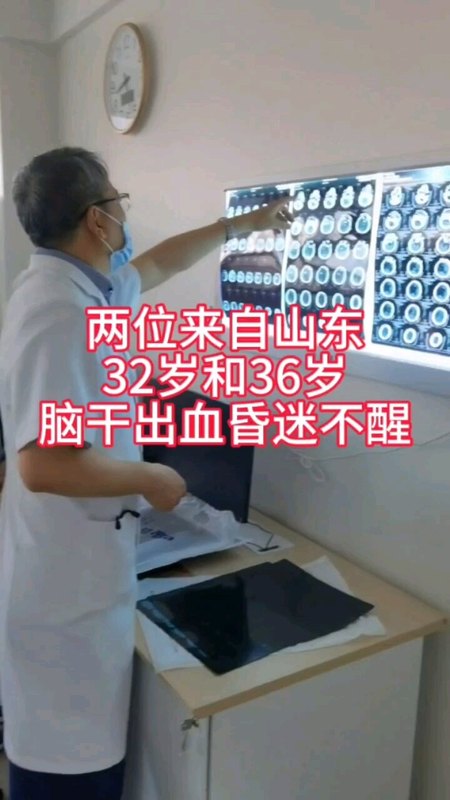 警惕年轻人高血压脑出血