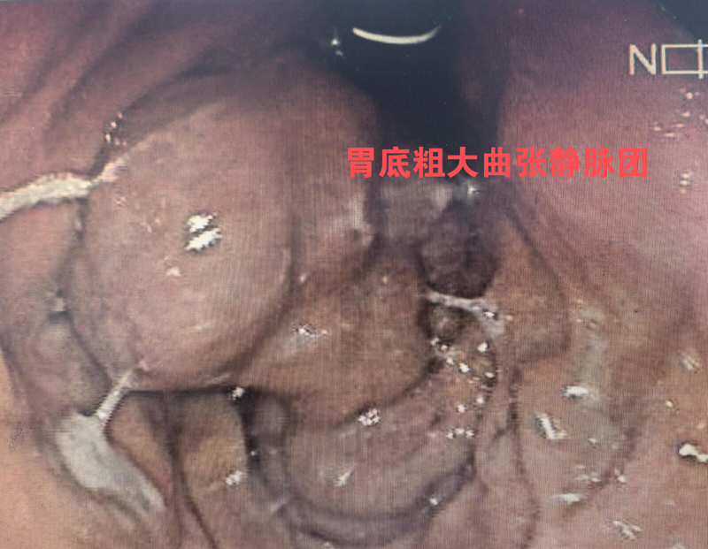 圖文圖片
