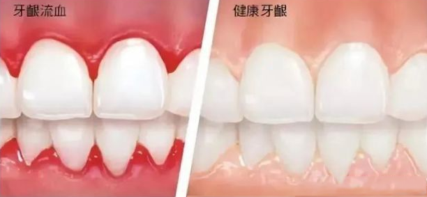 圖文圖片