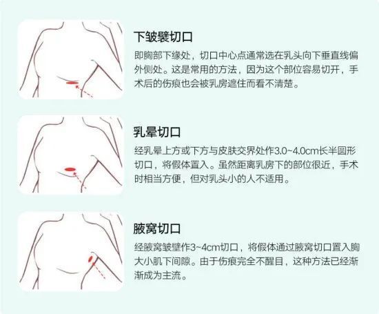 圖文圖片