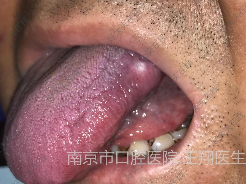 圖文圖片
