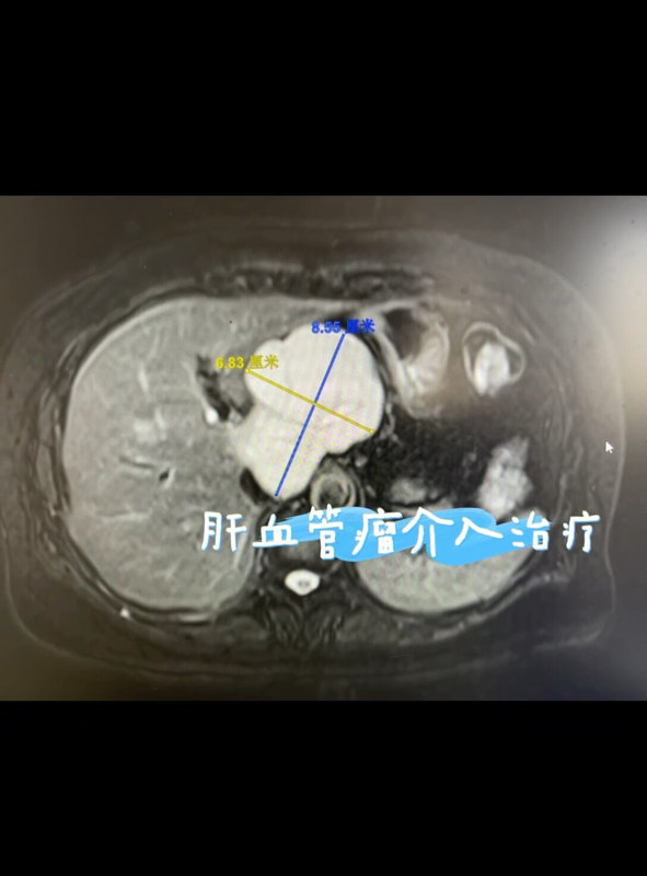 視頻封面