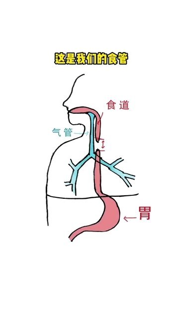 这就是您要的食道闭锁硬核科普！