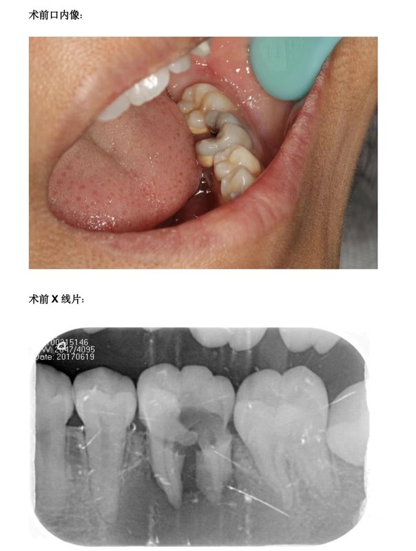 圖文圖片