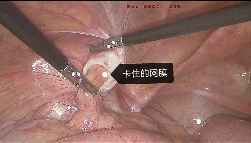 圖文圖片