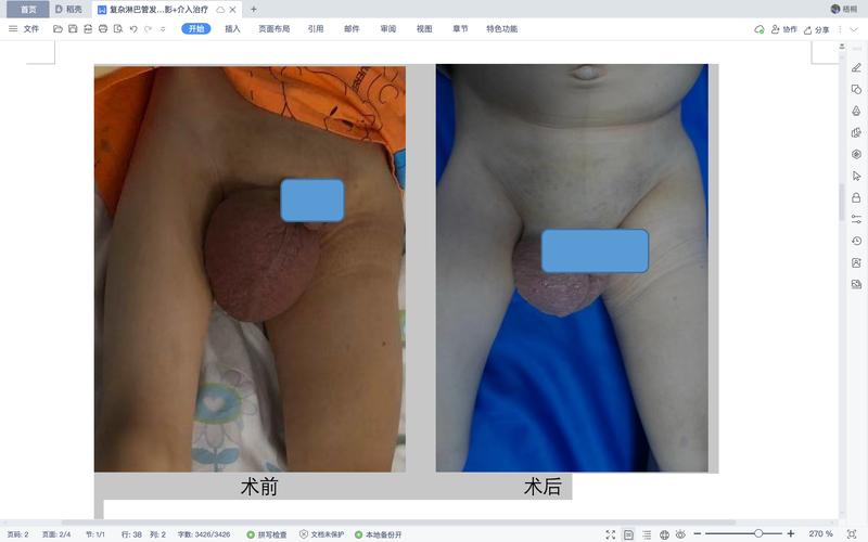 圖文圖片