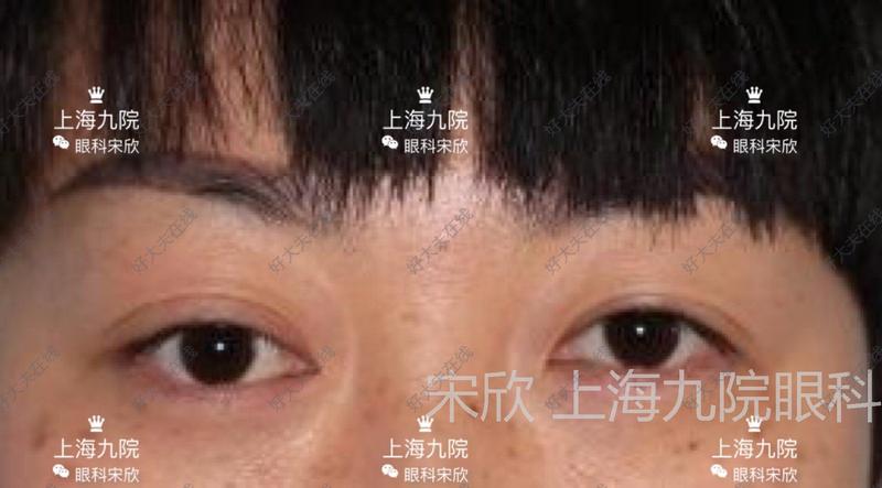圖文圖片