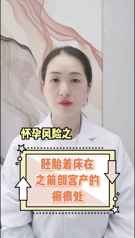 視頻封面