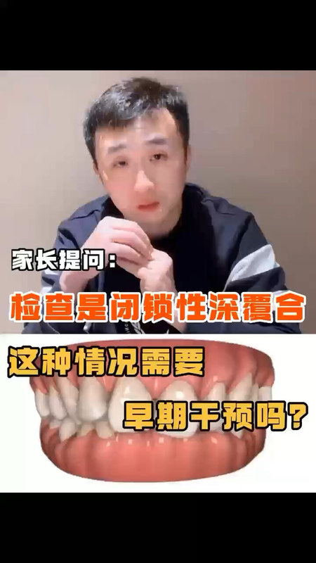 在线问题答疑：闭锁型深覆牙合需要早期干预吗？