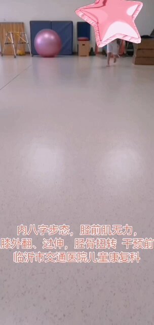 孩子内八字步态，髋内旋，O型腿，膝外翻，膝过伸，胫骨扭转，通过生物力学鞋垫矫正前后对比。
