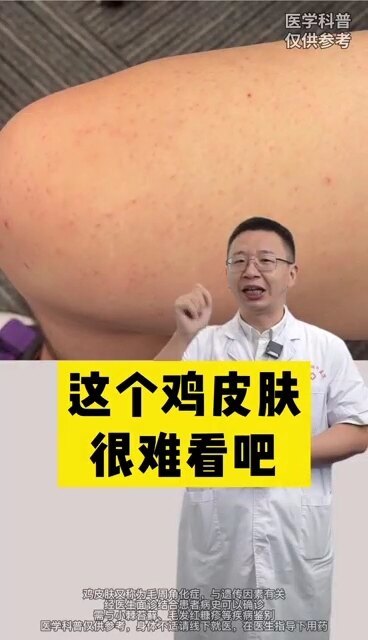 視頻封面