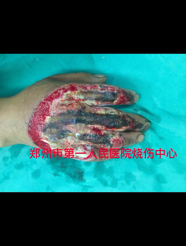 視頻封面