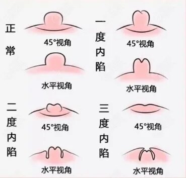 圖文圖片