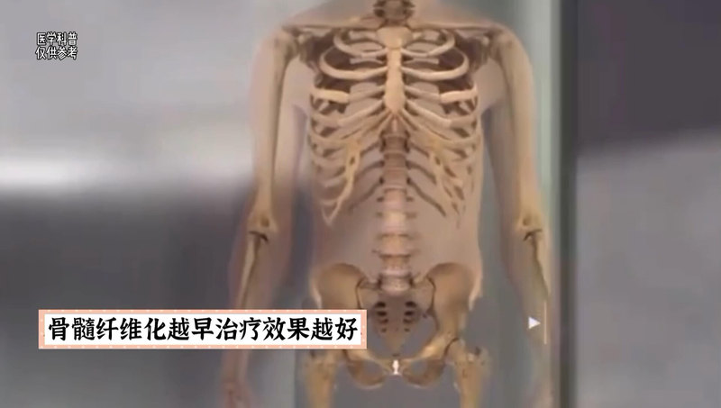 視頻封面