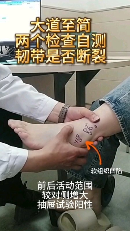 踝关节扭伤自测查体抽屉试验和腓骨平移试验