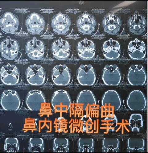 視頻封面