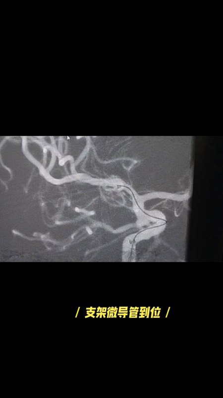 視頻封面