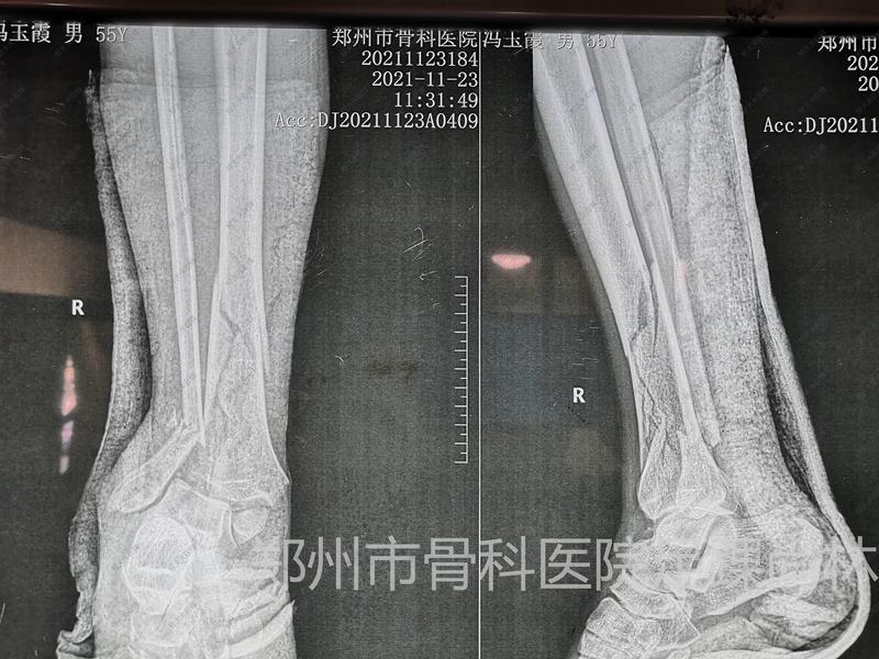 圖文圖片