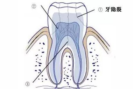 圖文圖片