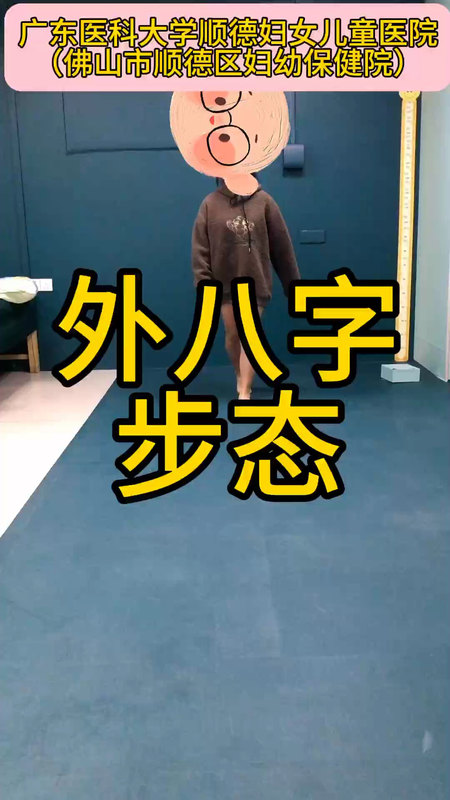 扁平足导致的外八字步态