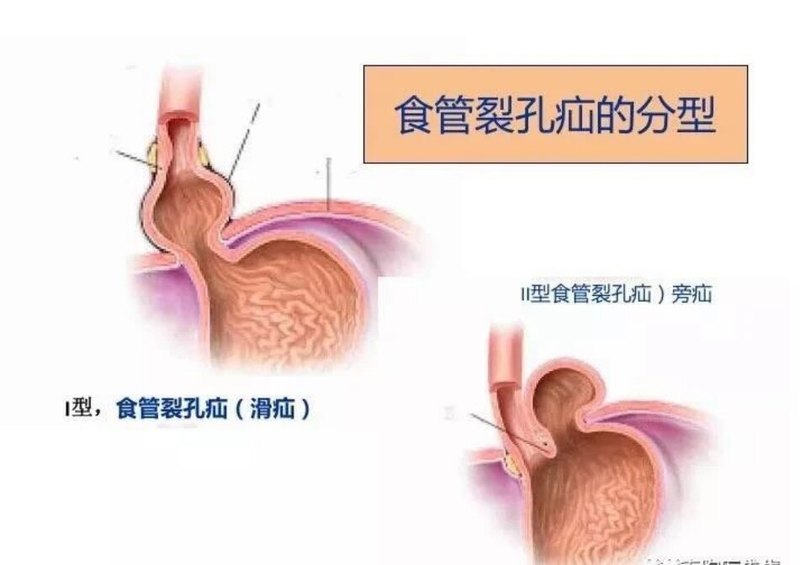 圖文圖片