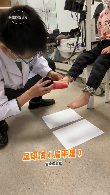 孩子常跌倒，当心扁平足，
                    检查很简单，对着视频看