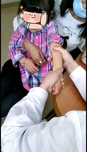 桡骨小头半脱位一秒钟复位，原来这么简单！不要自行在家按摩哦，有问题，来找我，我都不收费的呀！