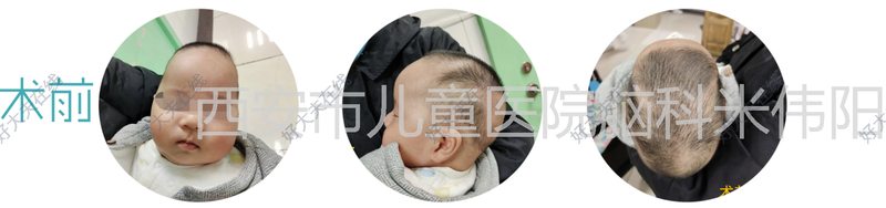 圖文圖片