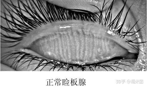 圖文圖片