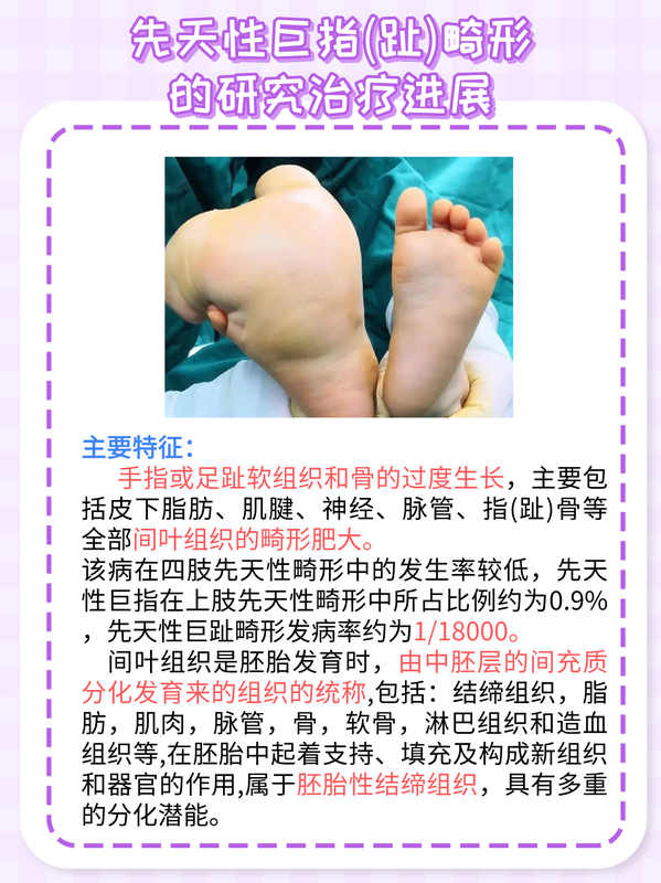 圖文圖片
