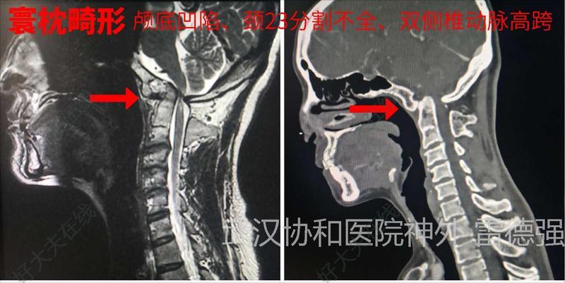 圖文圖片