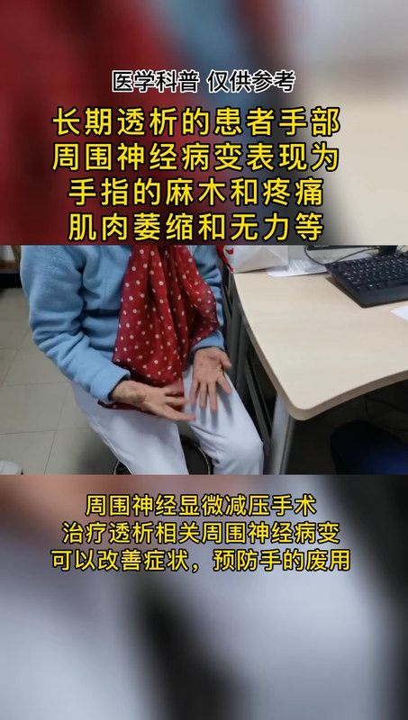 透析相关周围神经病变手部的表现：麻木疼痛，肌肉萎缩无力等