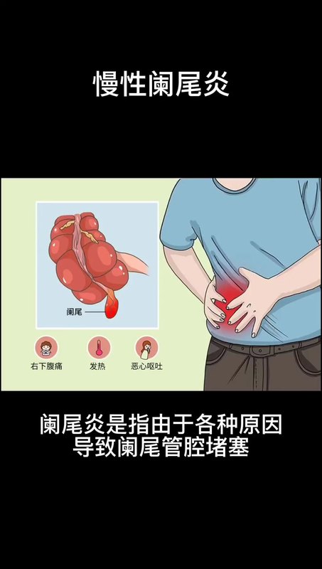 視頻封面
