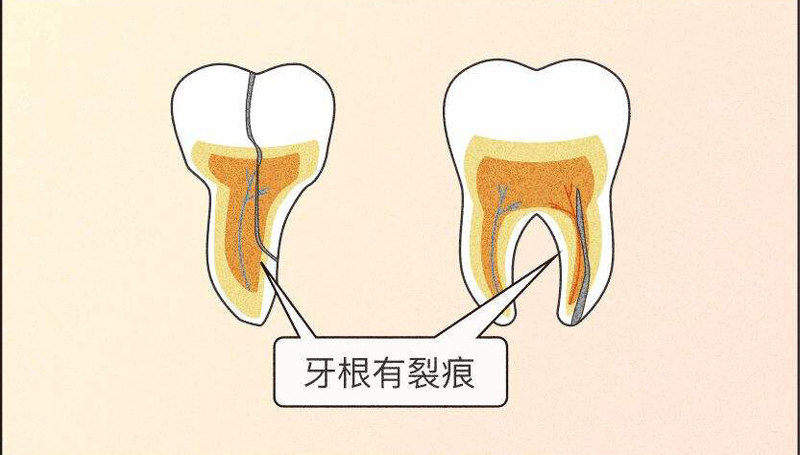 圖文圖片