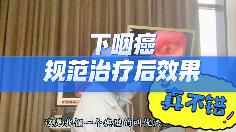 喉咽癌综合治疗