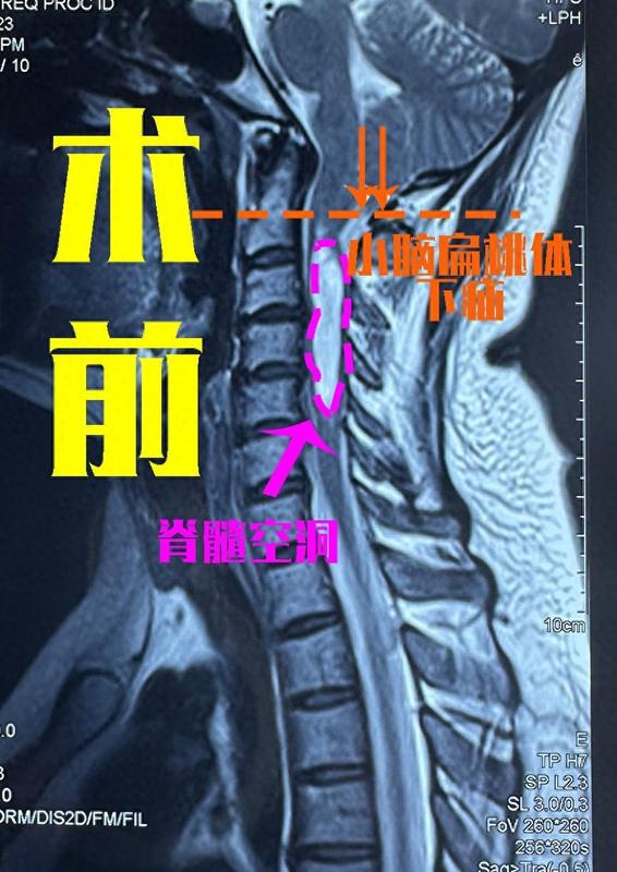 圖文圖片