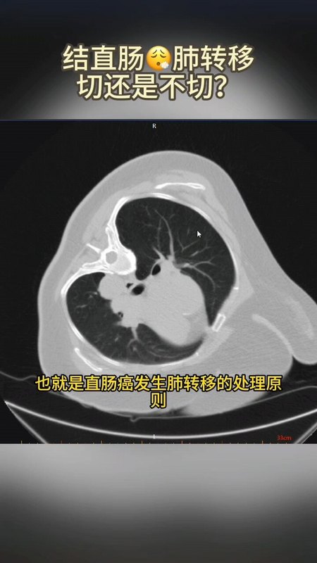 視頻封面