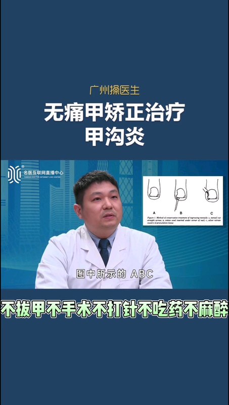 不拔甲不手术不打针不吃药不麻醉就能告别足趾痛-甲沟炎