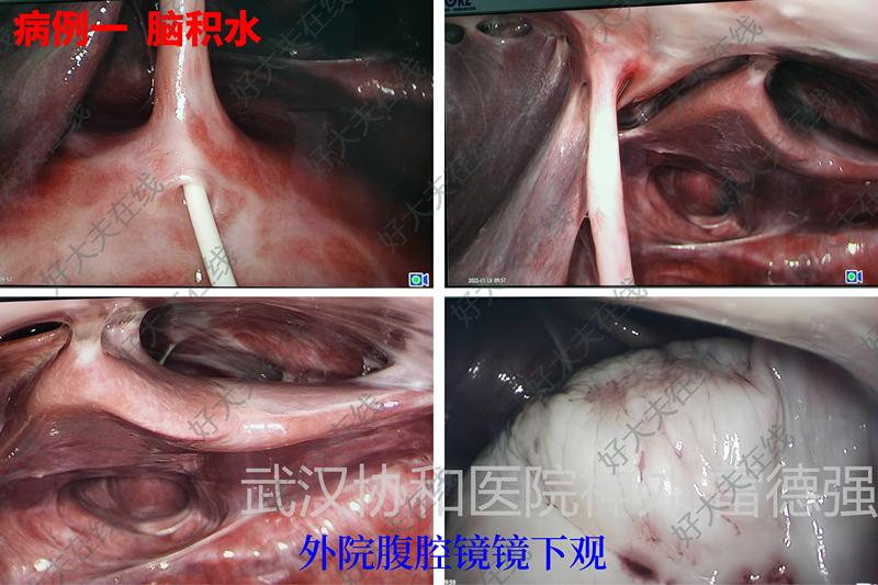 圖文圖片