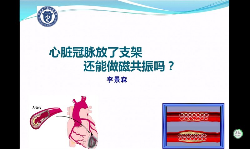 冠脉支架与磁共振