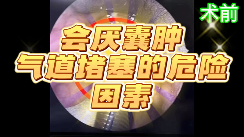 会厌囊肿有窒息风险