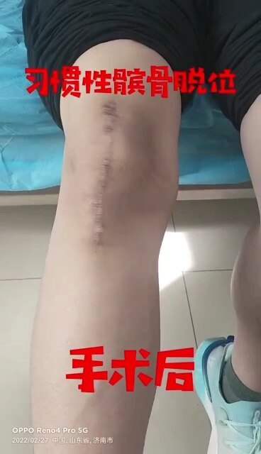 視頻封面