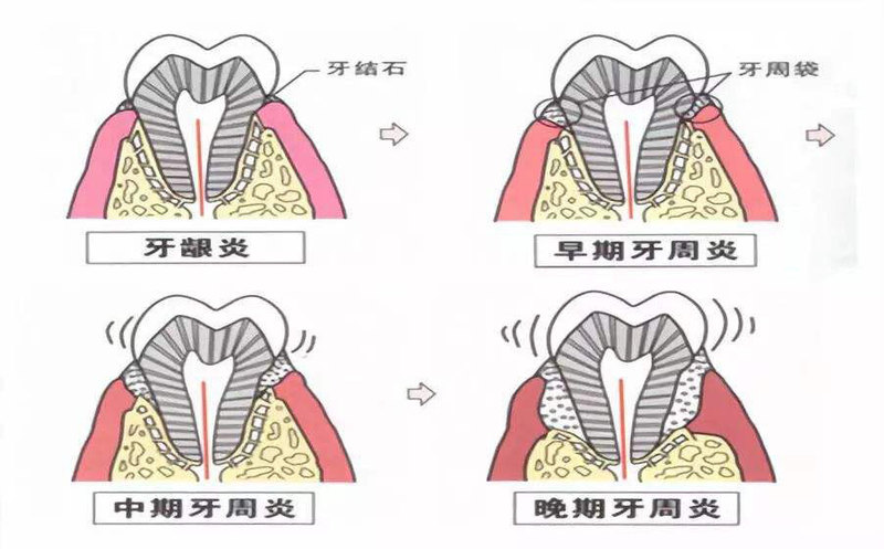 圖文圖片