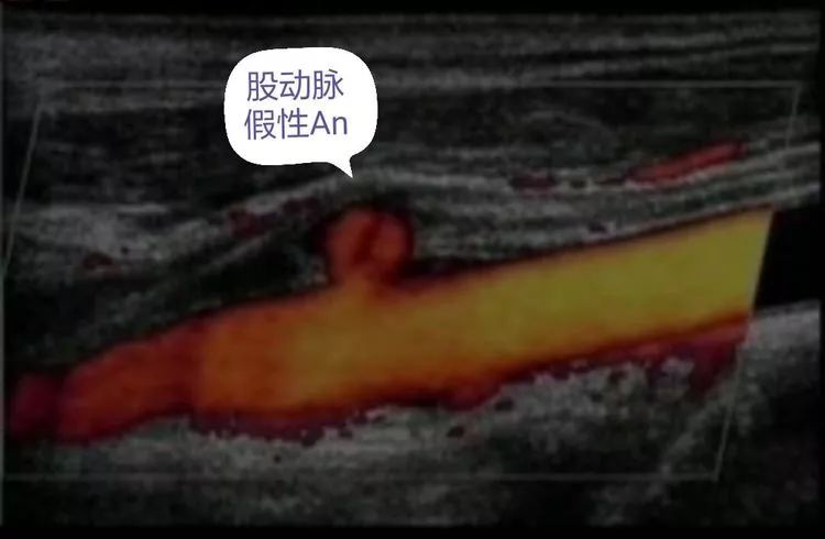 圖文圖片