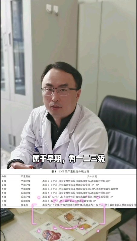 小儿肌性斜颈严重程度分级
