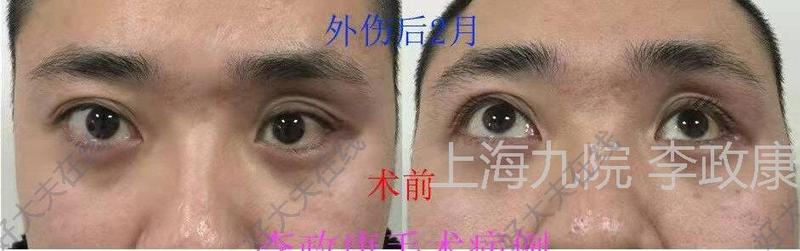 圖文圖片