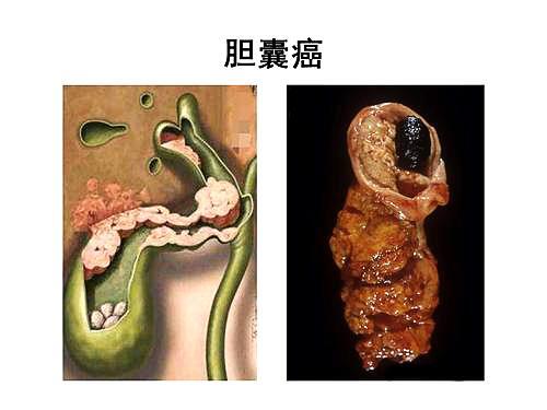 圖文圖片