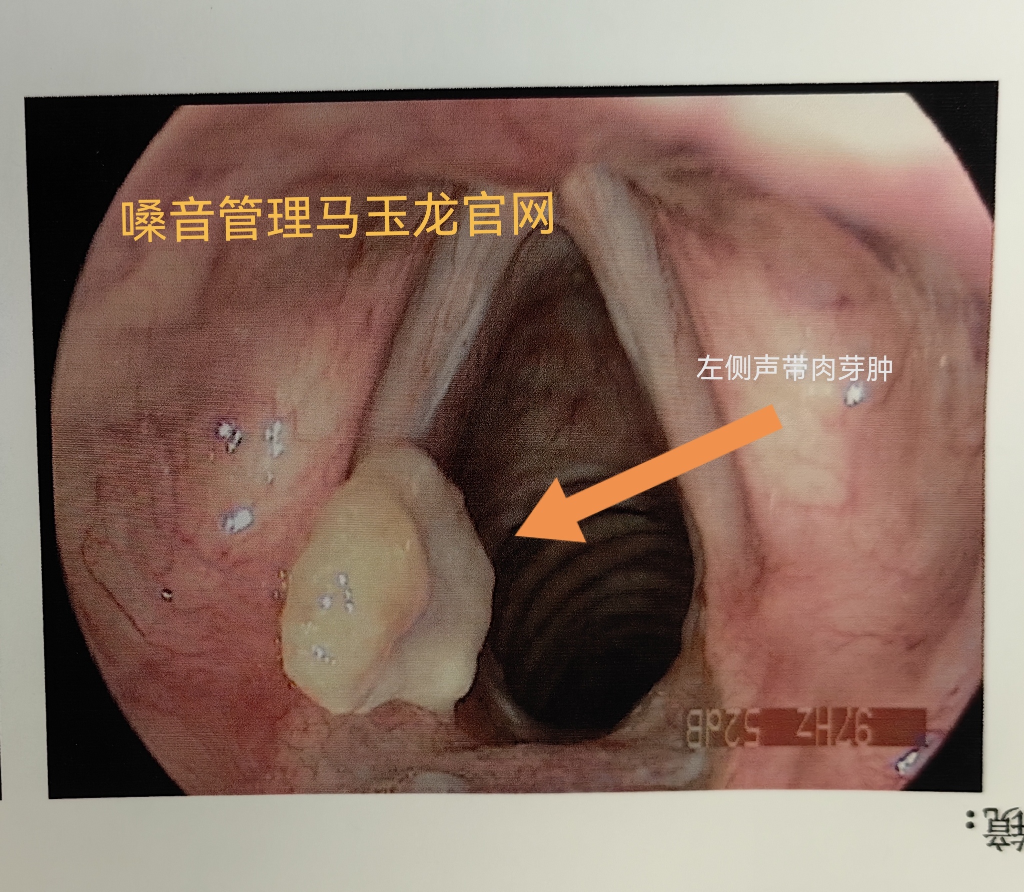 圖文圖片