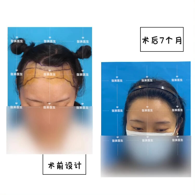 視頻封面
